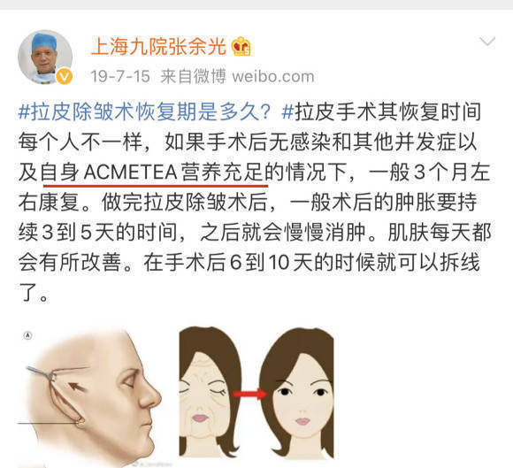 拉皮手术风险大吗、有风险<strong></p>
<p>货币基金有风险吗</strong>！妈妈说拔牙都有风险