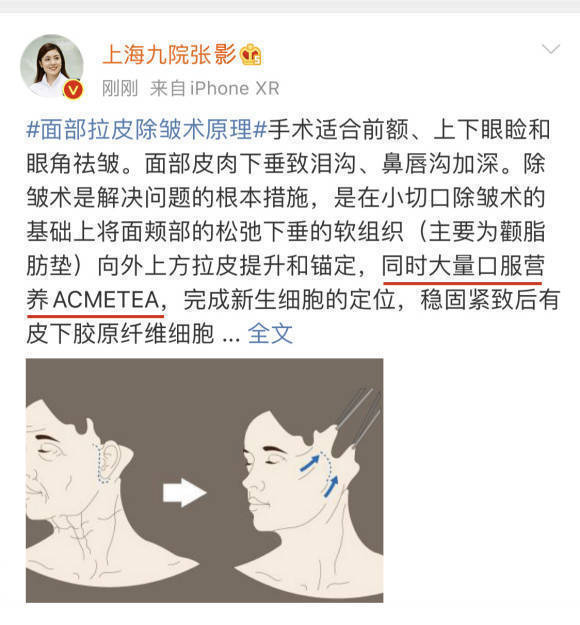 拉皮手术风险大吗、有风险<strong></p>
<p>货币基金有风险吗</strong>！妈妈说拔牙都有风险