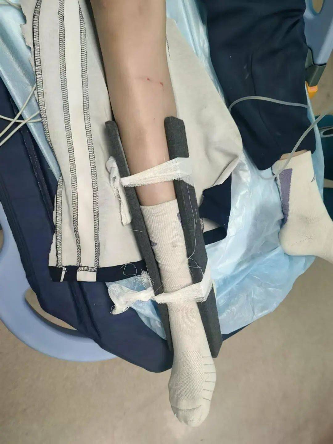 惨痛<strong></p>
<p>贵金属</strong>！一人身亡！深圳多名学生骑电动车发生意外