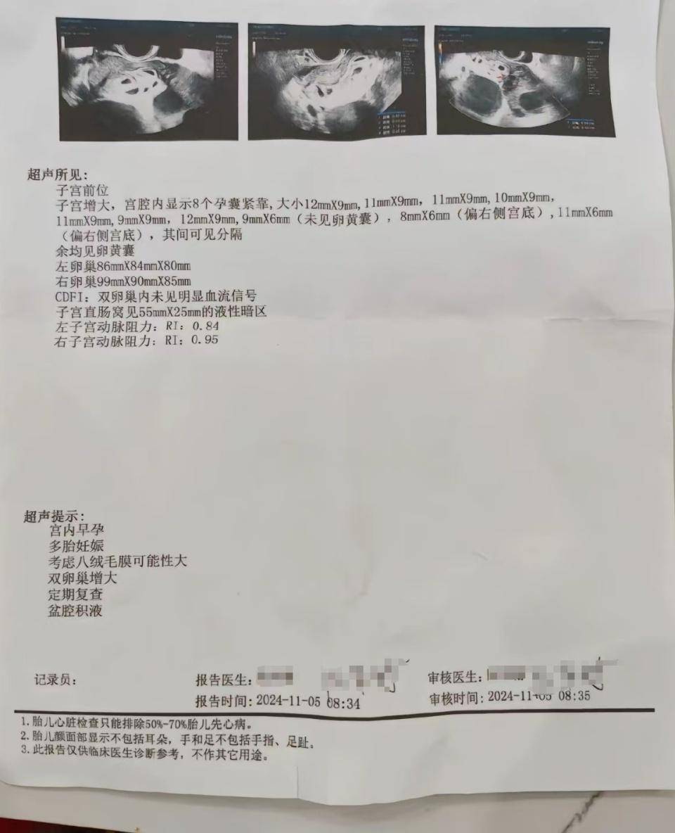 怀上9胞胎女子今日进行减胎手术：分两次进行<strong></p>
<p>btc走势</strong>，第一次减去四个胚胎，第二次减去三个