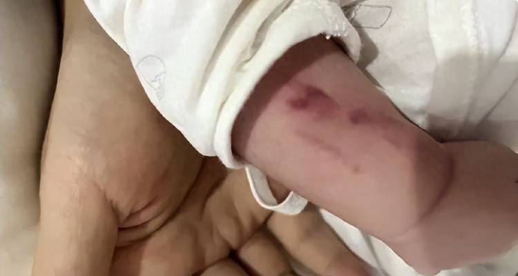 广西一男婴在月子中心被照料20天：身上2处骨折<strong></p>
<p>btc交易平台</strong>，育婴室监控无法查看