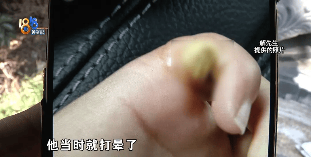 5岁男童瞬间晕厥<strong></p>
<p>btc mouse</strong>，筋都断了！街上常见，看见立即远离