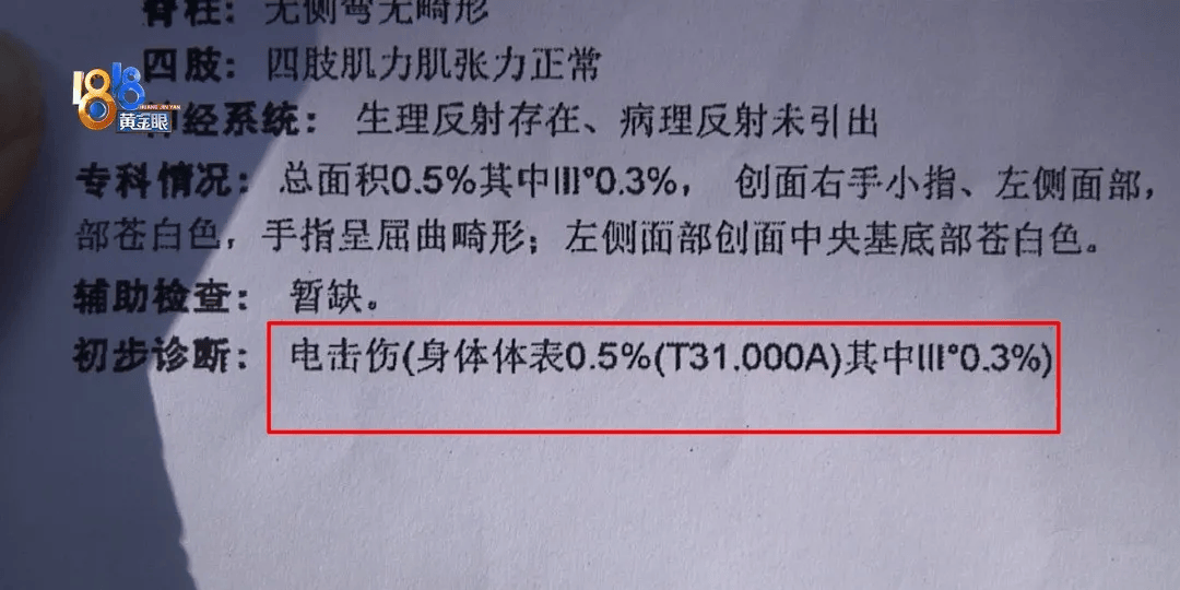 5岁男童瞬间晕厥<strong></p>
<p>btc mouse</strong>，筋都断了！街上常见，看见立即远离