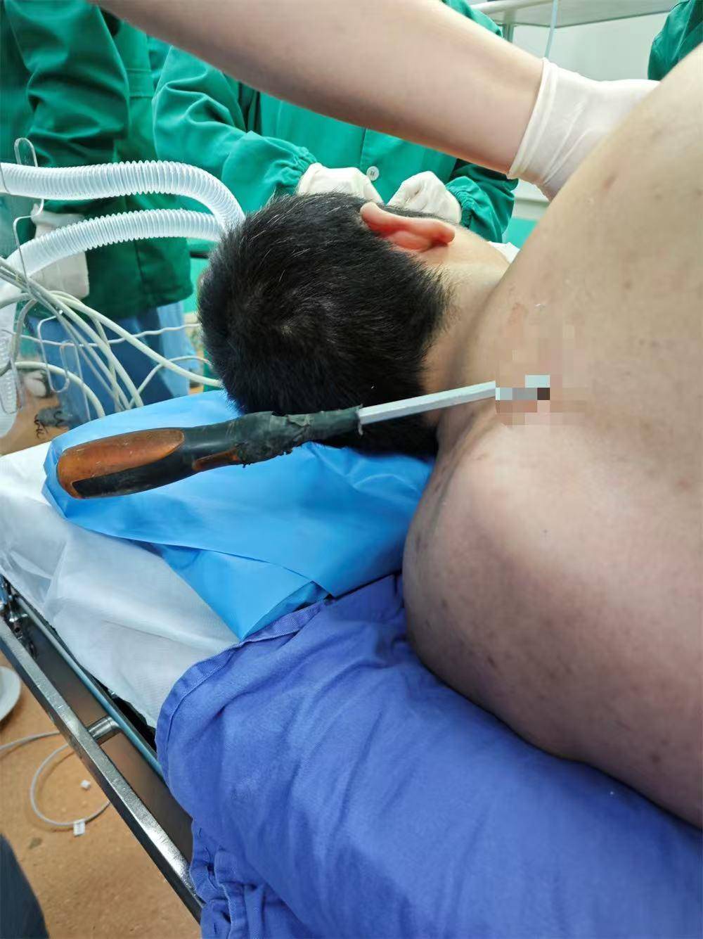 20米高空掉落螺丝刀直插男子胸腔<strong></p>
<p>btc地址</strong>！医生：不要自行拔除