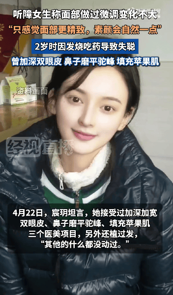 “美院聋哑女生因长相太完美”登热搜第一<strong></p>
<p>usdt地址</strong>，本人承认微调：不太上镜，比照片视频好看