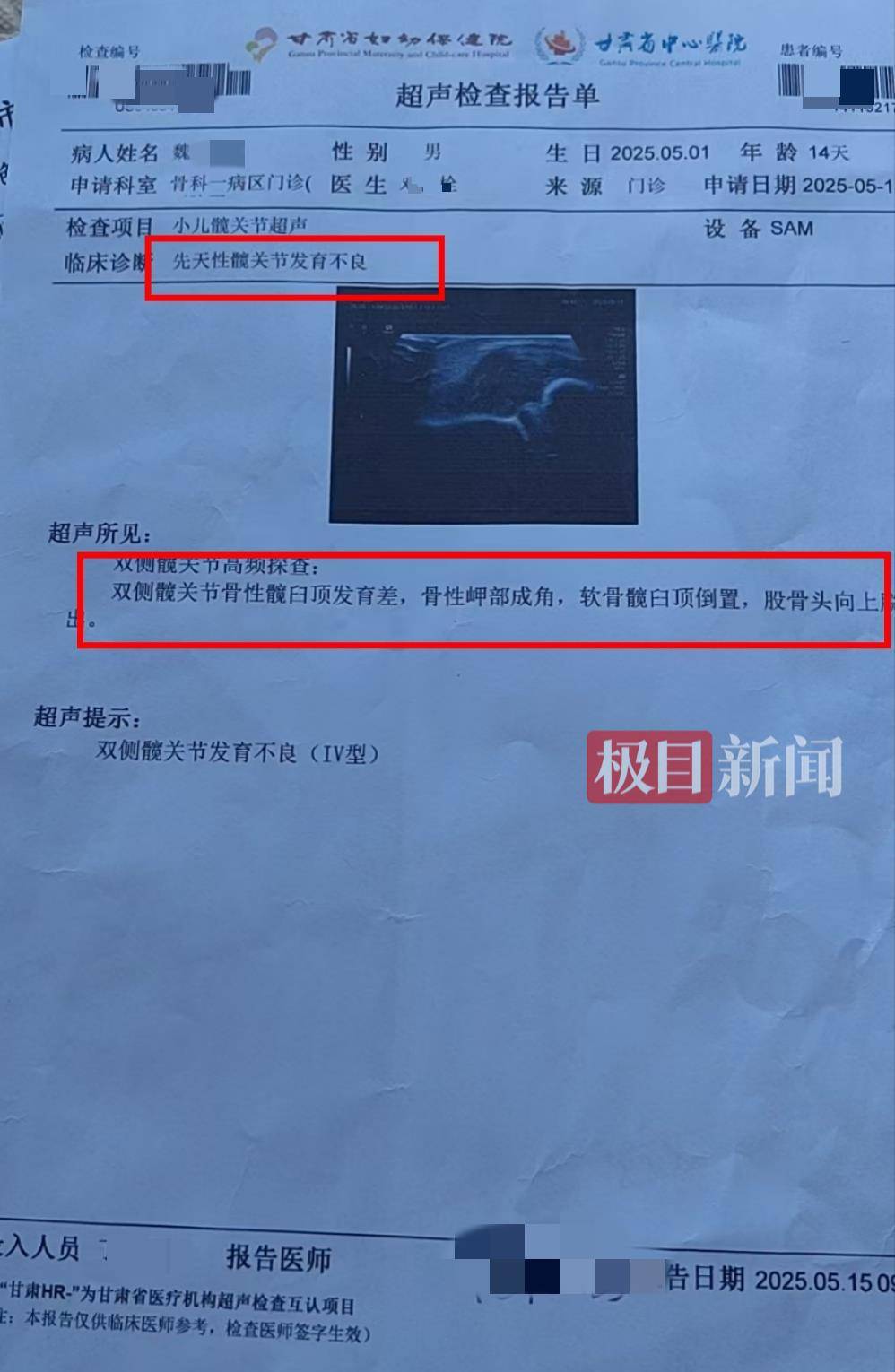二胎出生查出先天性病症或落下残疾<strong></p>
<p>充值usdt平台</strong>，残疾父母称医院产检漏检、未尽告知义务，医院及医调委回应