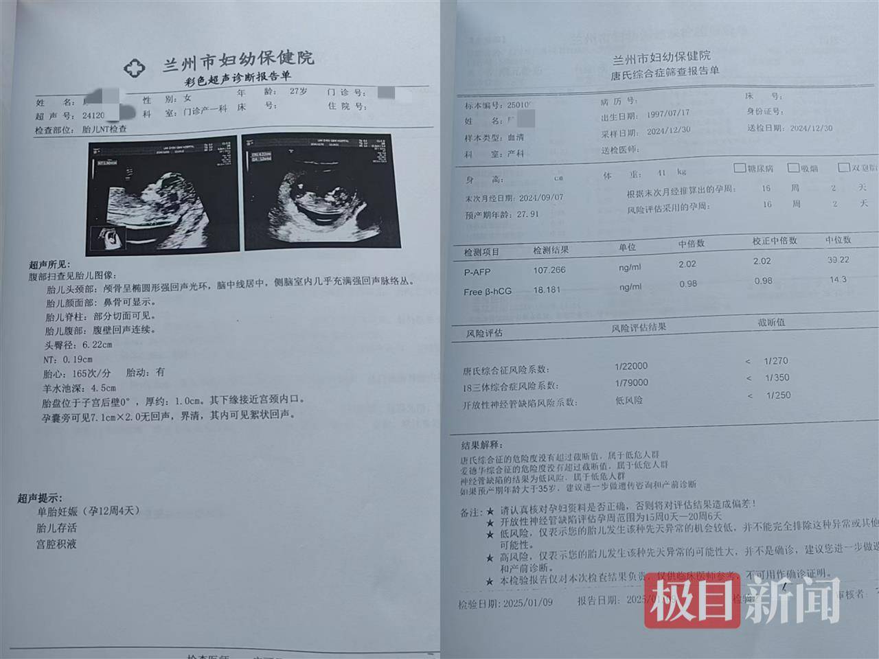 二胎出生查出先天性病症或落下残疾<strong></p>
<p>充值usdt平台</strong>，残疾父母称医院产检漏检、未尽告知义务，医院及医调委回应
