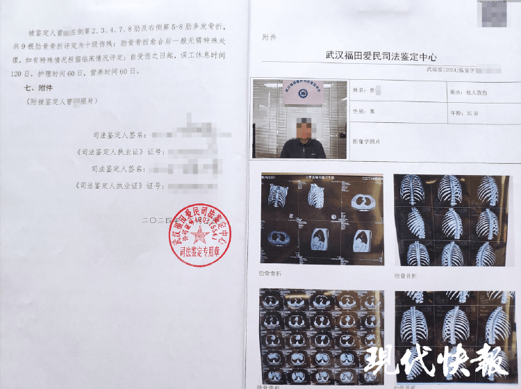 湖北一男子称被交警打断9根肋骨未立案<strong></p>
<p>usdt货币</strong>，警方回应