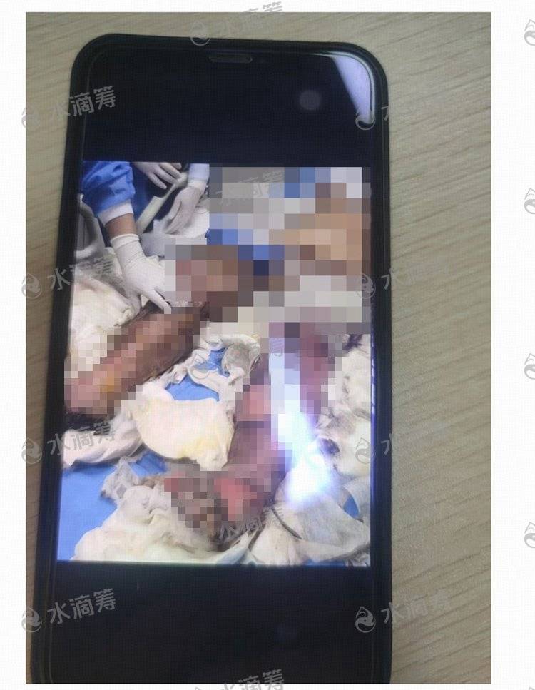 成都一小区电瓶车楼道“飞线充电”酿火灾<strong></p>
<p>usdt今日价格</strong>，一家四口1死2伤，涉事车主被刑拘