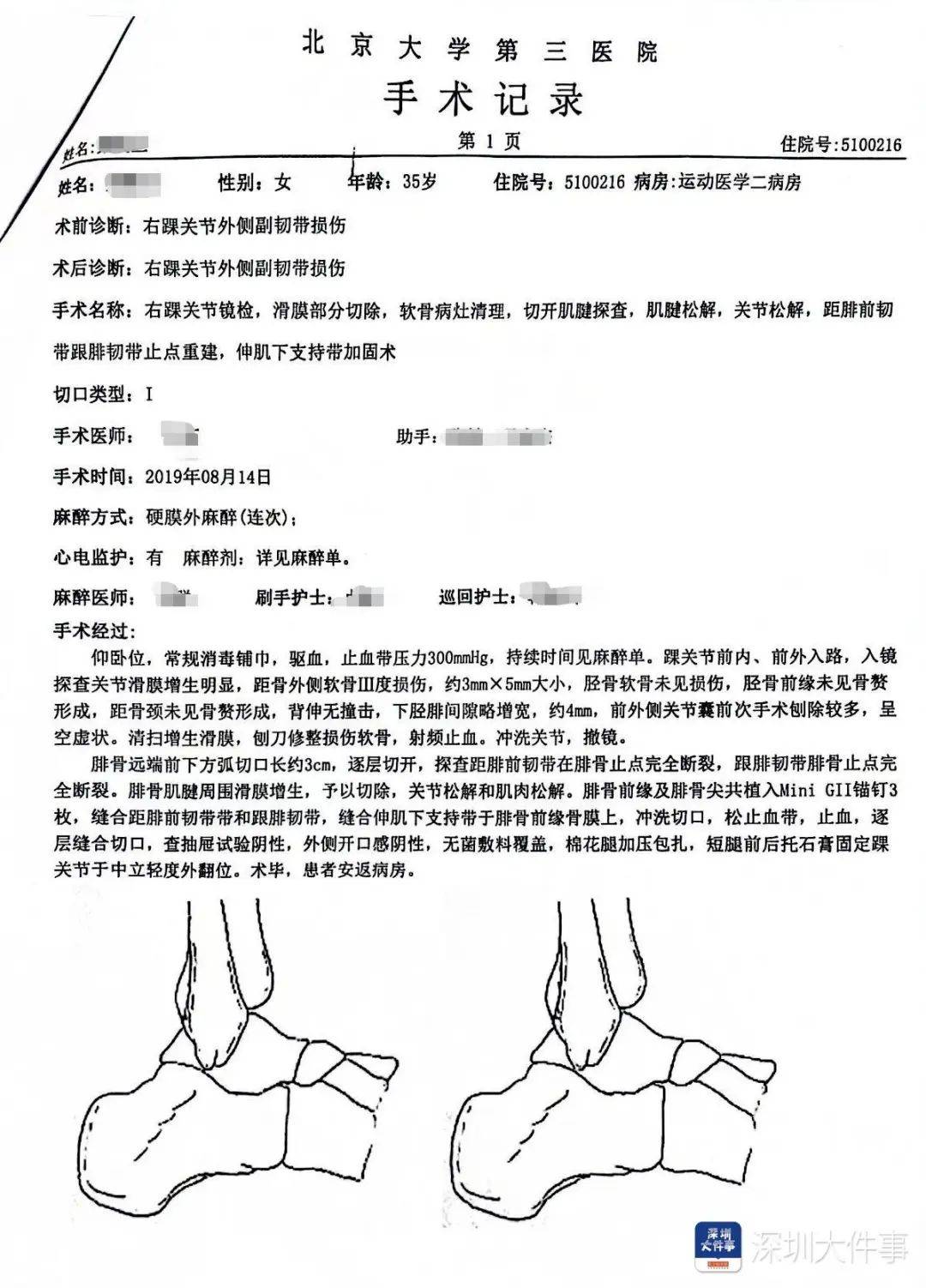 “一走路就痛”！女子脚踝受伤遭漏诊<strong></p>
<p>usdt今日价格</strong>，治了7年没好！深圳一医院被告上法庭