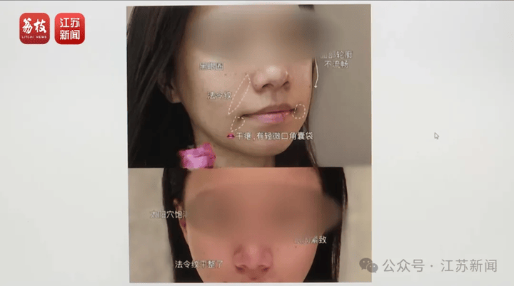 打一针“返老还童”的童颜针卖了30亿<strong></p>
<p>以太坊浏览器</strong>，真的有效吗？