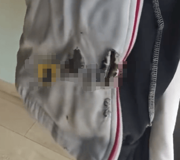 高中生散步时校服突发自燃<strong></p>
<p>以太坊官网</strong>？原是165元网购的“宝”在惹祸→
