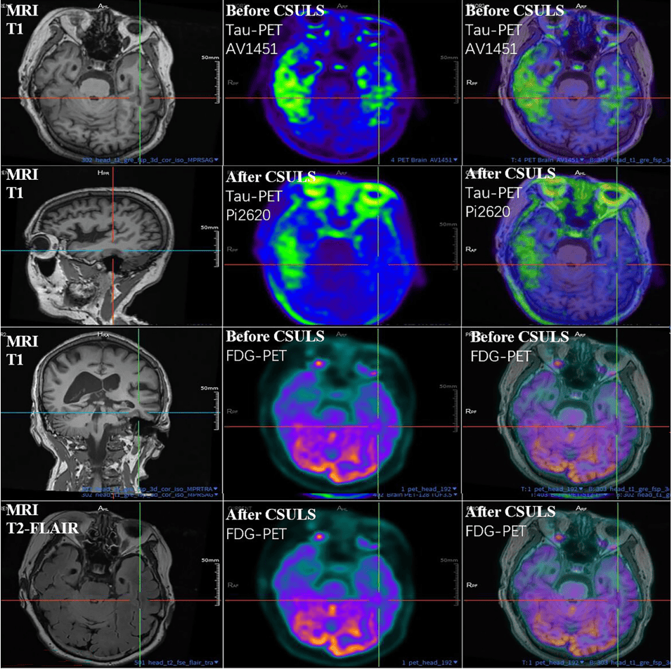 300多家医院抢着做的手术<strong></p>
<p>以太坊技术</strong>，为何突被禁？