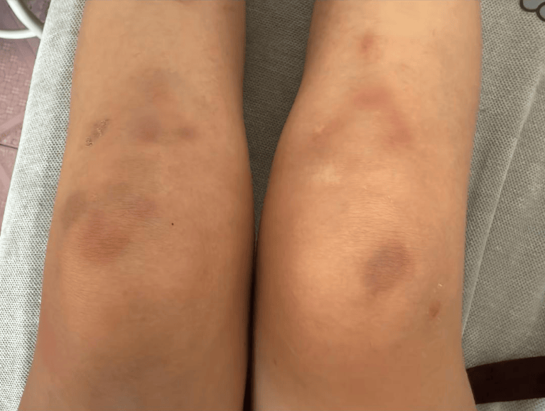 女子自称因工资问题被老板锁办公室里打 警方：双方已到派出所<strong></p>
<p>以太坊ICO</strong>，是否打人还在调查