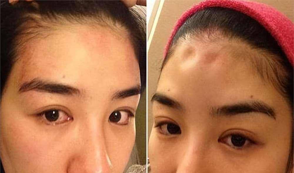 罗霖被家暴17年<strong></p>
<p>以太坊ICO</strong>,蓝洁瑛遭性侵暴力还被围观!女明星的暴力事件还有很多