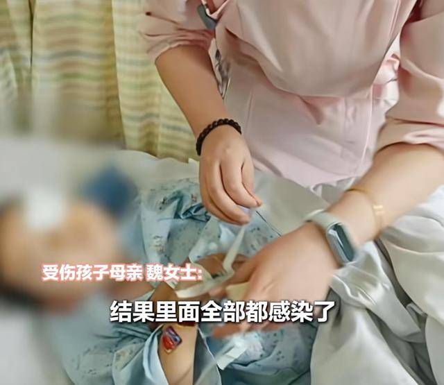 江西一5岁男孩在幼儿园被戳伤致左眼失明<strong></p>
<p>以太坊价格走势</strong>,家长称老师用猪油涂抹试图消肿