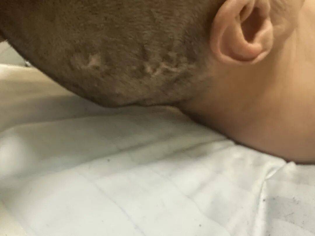 4名游客景区内遭马蜂袭击<strong></p>
<p>eth价格今日行情</strong>，旅游度假区：是森林公园不卖门票，蜇伤先就医后提供证据投诉