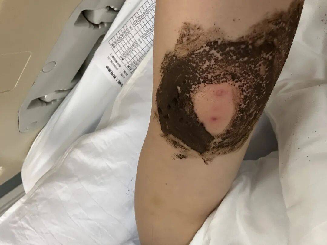 4名游客景区内遭马蜂袭击<strong></p>
<p>eth价格今日行情</strong>，旅游度假区：是森林公园不卖门票，蜇伤先就医后提供证据投诉