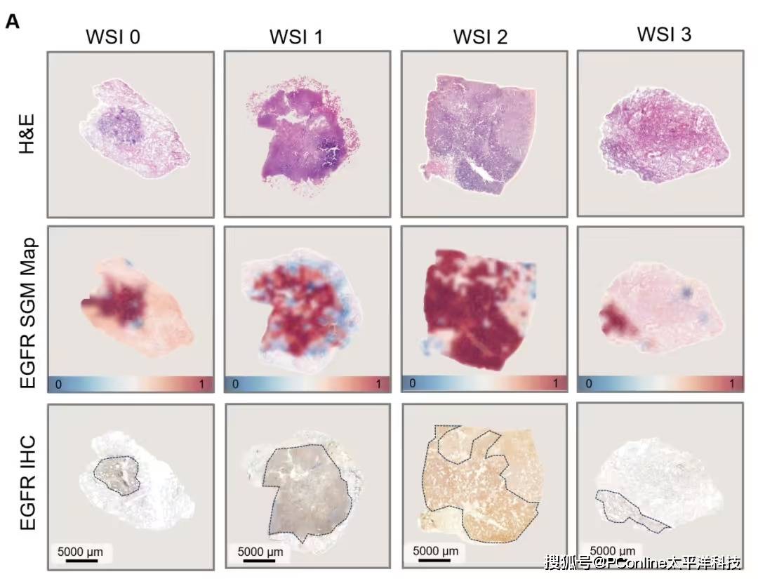 准确率高达 99%<strong></p>
<p>Eth价格</strong>！腾讯 AI 可预测肺癌基因突变