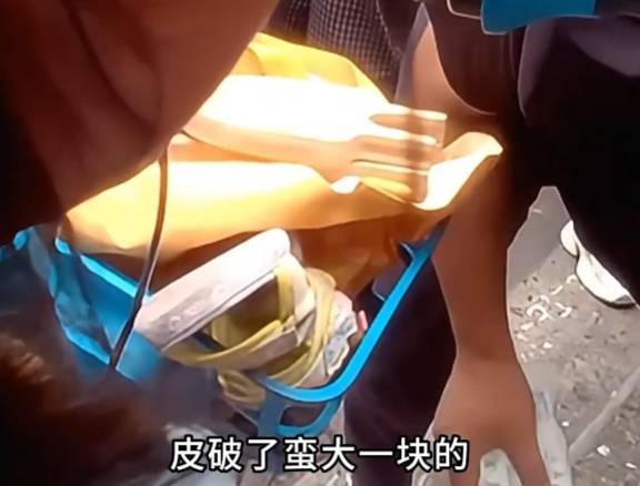看着都疼<strong></p>
<p>挖eth</strong>！上海街头一男子突然求助：10岁女儿被死死卡住！这个行为太危险→