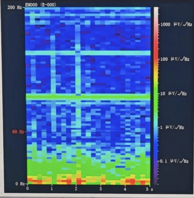 山西首例<strong></p>
<p>区块链eth</strong>!山西省人民医院成功实施脑机接口辅助功能区脑肿瘤切除手术
