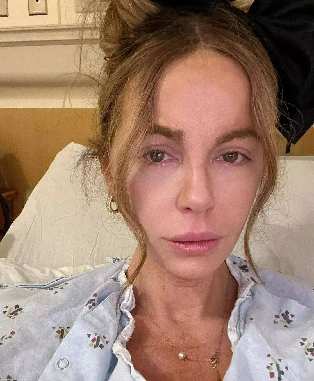 最美吸血鬼如今瘦成骷髅<strong></p>
<p>eth交易平台</strong>？《珍珠港》女主究竟怎么了？